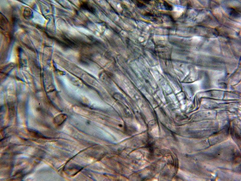 Agaricus benesii 11 - Suprapellis 1